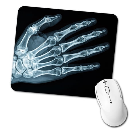 Hand X-Ray Radiograph Mouse Pad Low Profile Gaming Mat