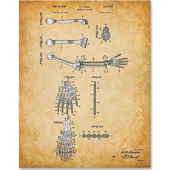 Hand and Arm Bones - 11x14 Unframed Art Print - Great Gift for Medical and Nursing Students