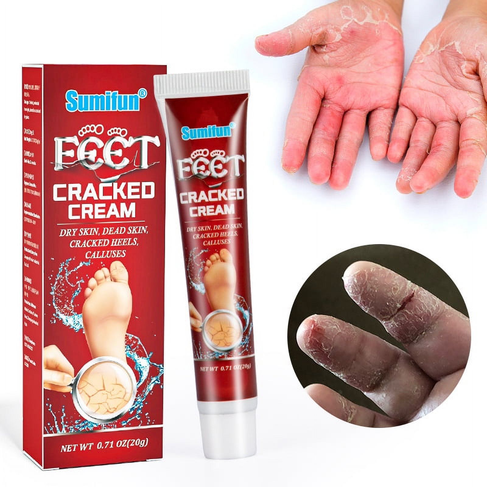 Hand and Foot Cracked Cream,Suitable for Rough, Dry and Chapped Feet