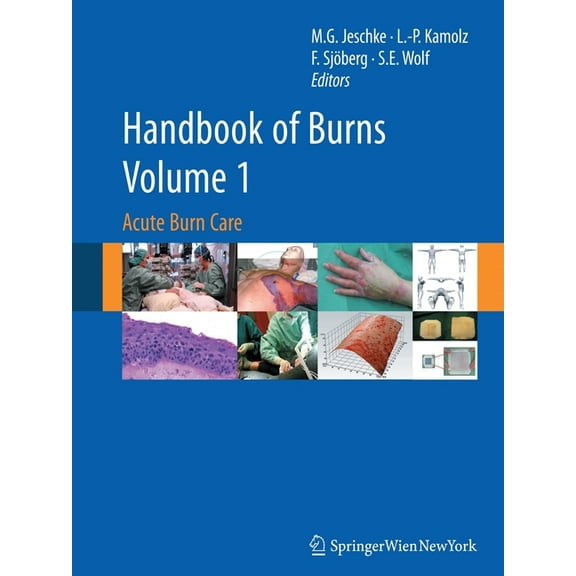Handbook of Burns, Volume 1: Acute Burn Care, (Paperback)