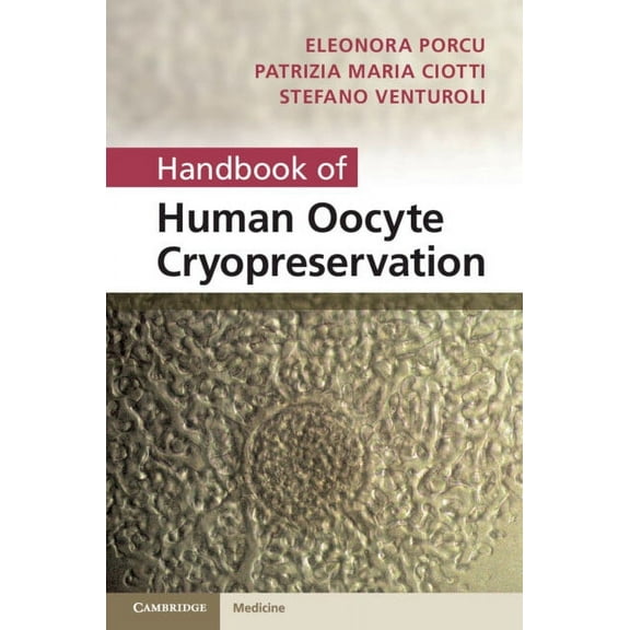 Handbook of Human Oocyte Cryopreservation, (Hardcover)