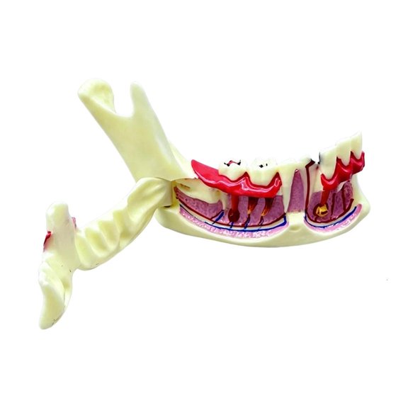 HannLk Jaw Bone Anatomy Model With Detachable Gingival For Clinics Training