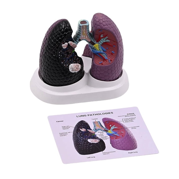 HannLk Realistic Human Lung Anatomy Model Anatomical Lung Model Teaching Tool