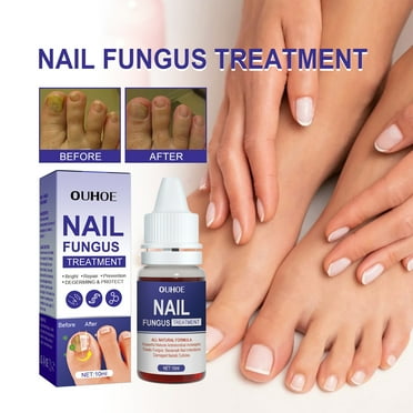 Haobuy Nail Repair Essnce Liquid, Fix & Renew Strengthen Damaged Discolored Nails