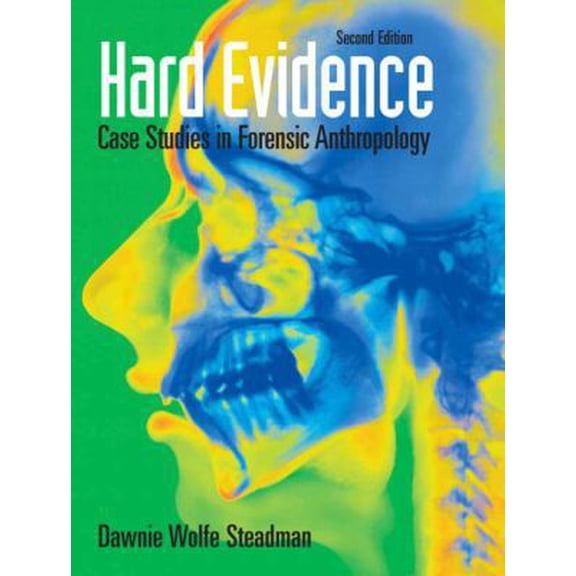Pre-Owned Hard Evidence: Case Studies in Forensic Anthropology (Paperback) 0136050735 9780136050735