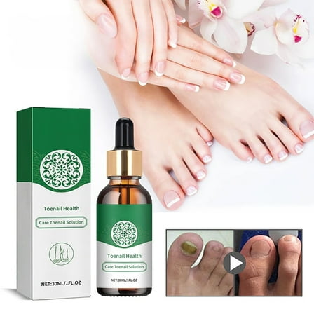 Hauiodp Toenail Care Solution Hand Foot Nail Repair Shine Nail Soft Nail Ingrown Nail Care Solution 30ml