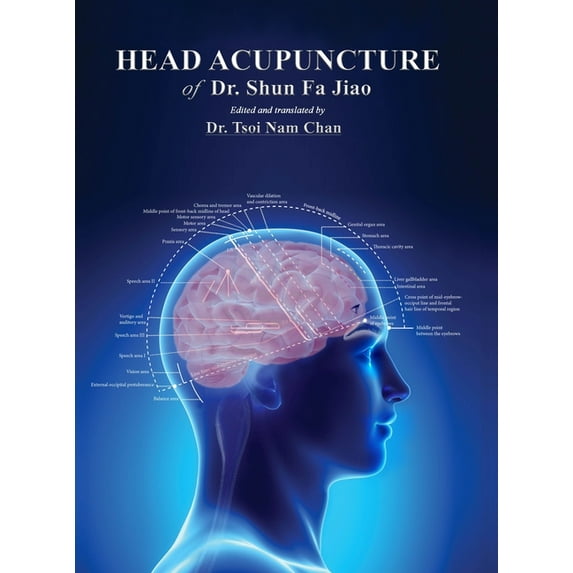 Head Acupuncture of Dr. Shun Fa Jiao (Hardcover)