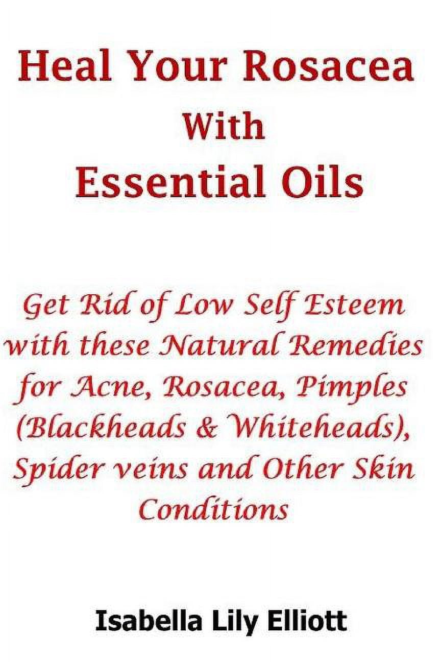 Heal Your Rosacea with Essential Oils: Get Rid of Low Self Esteem with ...