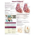 thumbnail image 1 of Heart Failure Anatomical Chart (Other), 1 of 1