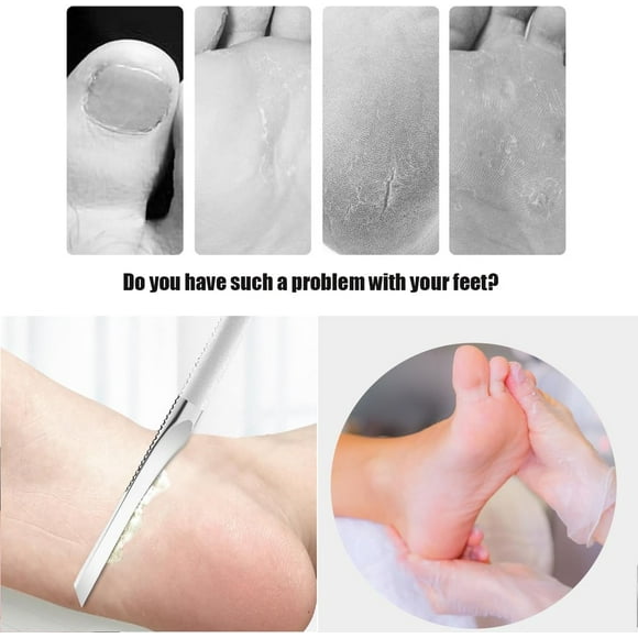 Heavy Duty Ingrown Podiatrist Toenail Tool,Nail Clipper Stainless Steel Long Handle Cosmetic Pedicure Set for Ingrown and Thick Nails for Callus Corn Removal (3)