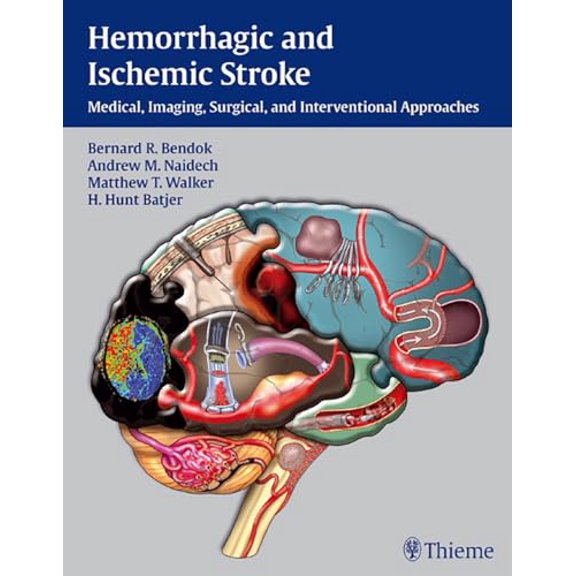 Pre-Owned Hemorrhagic and Ischemic Stroke: Medical, Imaging, Surgical and Interventional Approaches, 9781604062342, 1604062347, Hardcover, 1 edition