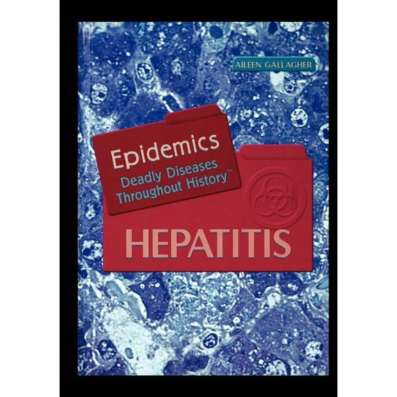 Hepatitis (Paperback)