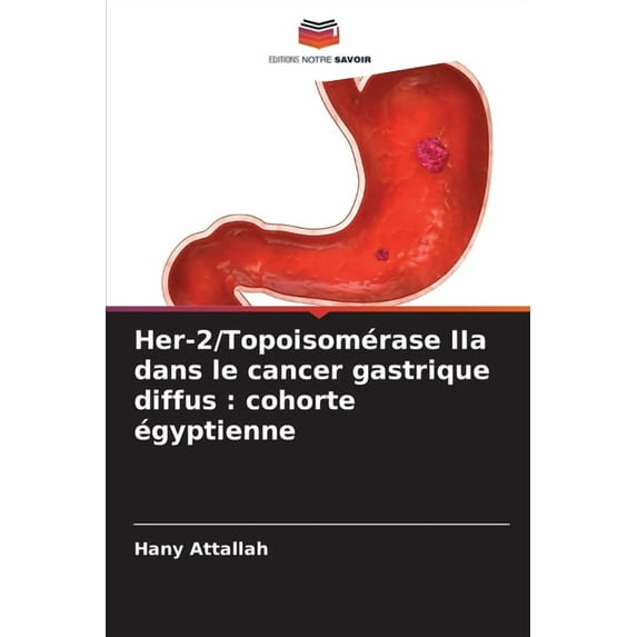 Her-2/Topoisomérase IIa dans le cancer gastrique diffus: cohorte égyptienne, (Paperback)