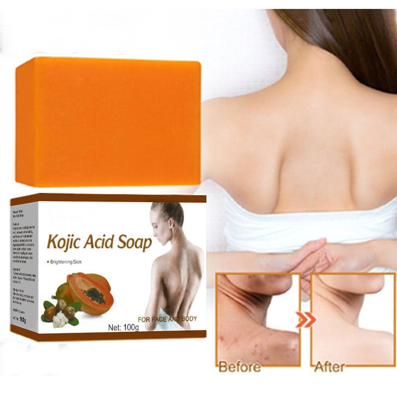Natrulo Papaya Brightening Soap Bar - Kojic Acid & Turmeric For Dark Spots, Acne & Even Skin Tone, All Skin Types