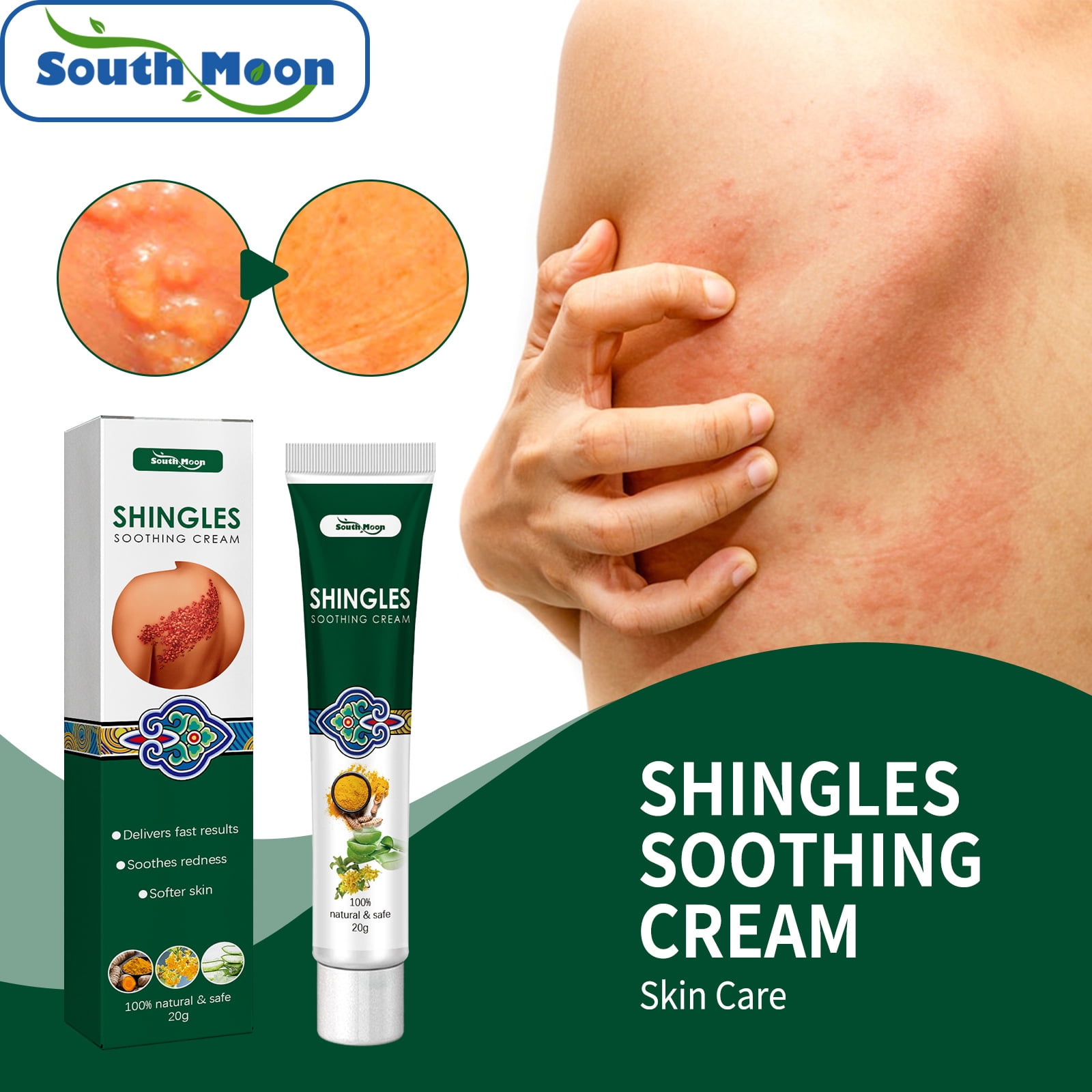 gabapentin cream for shingles