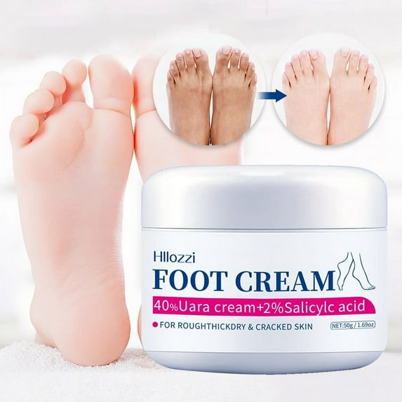 Herunwer Urea Cream for Feet Maximum Strength, Urea Foot & Hand Cream for Dry Cracked, Foot Dead Skin Cuticle Callus Remover Toenail Softener