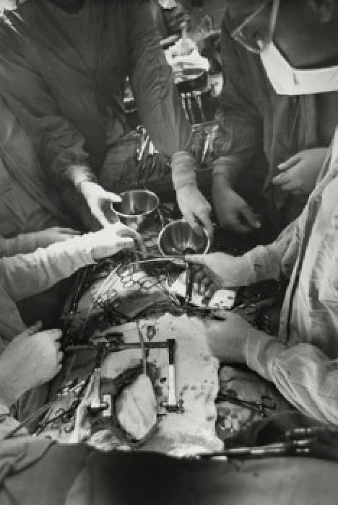 High angle view of surgeons performing open-heart surgery Canvas Art - (24 x 36)