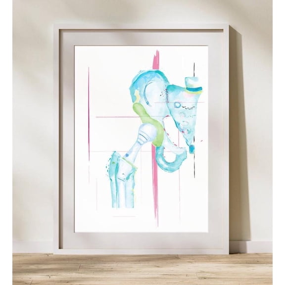 Hip Replacement Orthopedic Wall Art Print, Unframed Paper Poster 8x10in