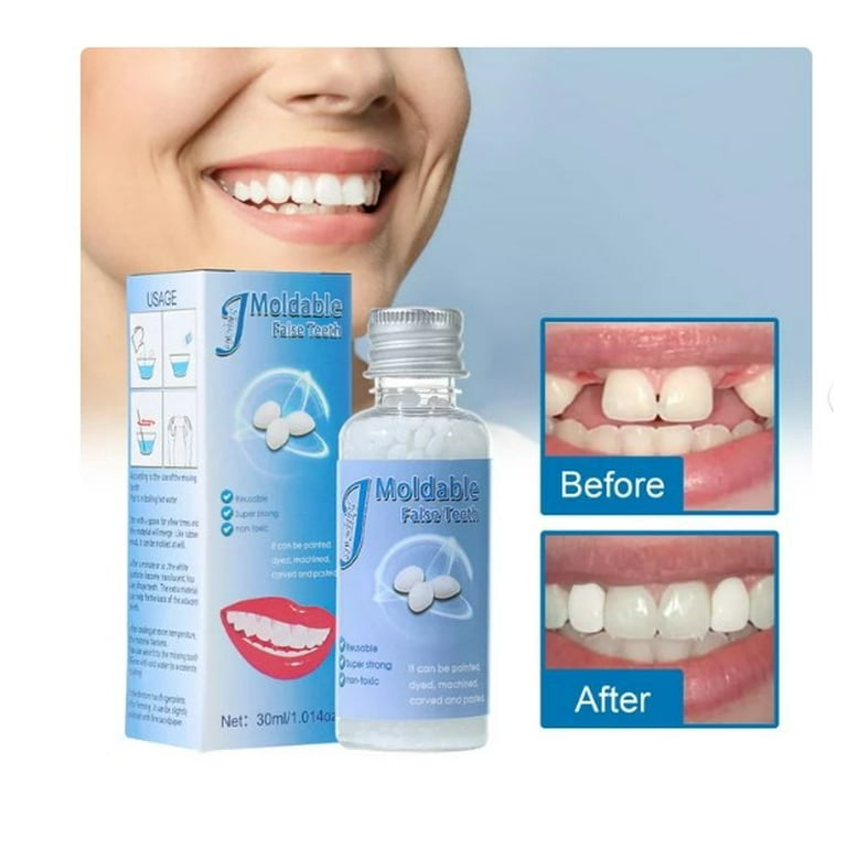 Hiroke Teeth Repair Kit, Temporary False Teeth Moldable False Teeth for  Snap on Instant and Confident Smile 2Pcs