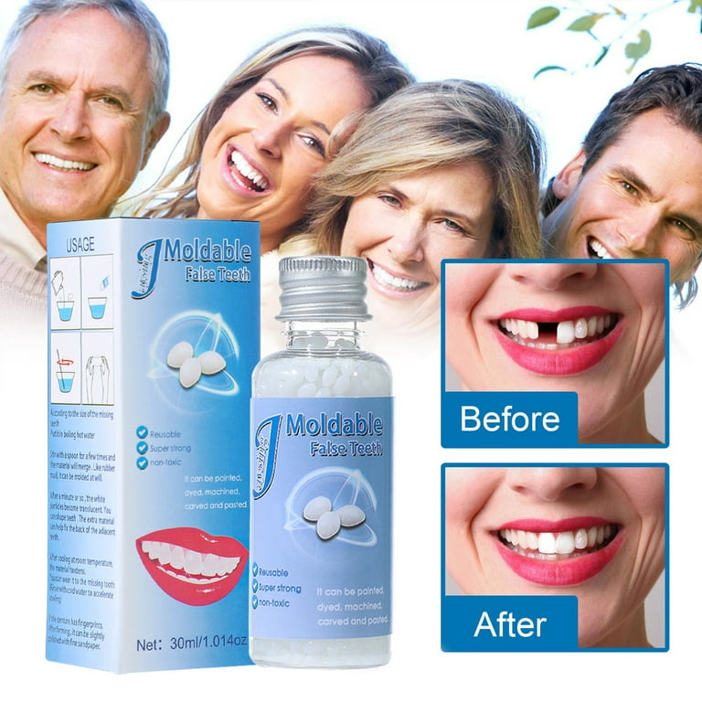 Hiroke Teeth Repair Kit, Temporary False Teeth Moldable False Teeth for  Snap on Instant and Confident Smile