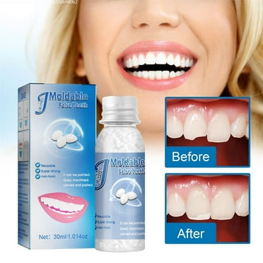 Hiroke Teeth Repair Kit, Temporary False Teeth Moldable False Teeth for Snap on Instant and Confident Smile