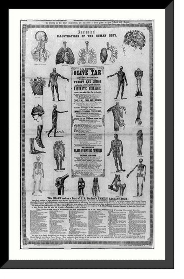 Historic Framed Print, Anatomical, illustrations of the human body, 17 ...
