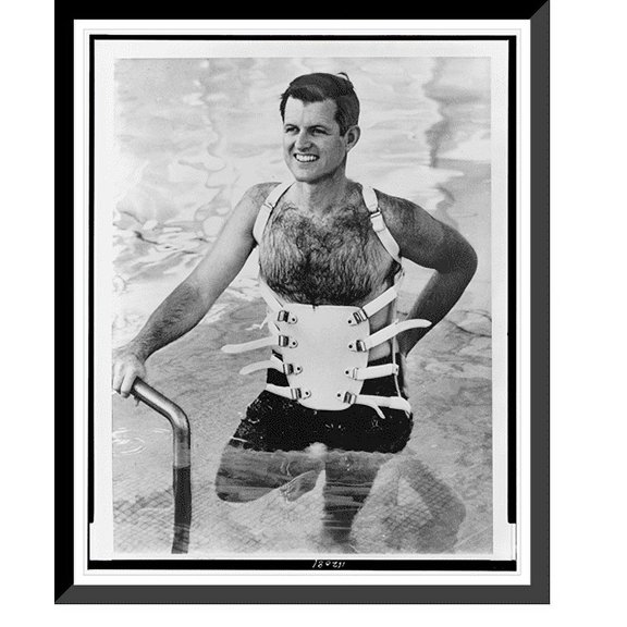 Historic Framed Print, Swimming pool therapy, 17-7/8" x 21-7/8"