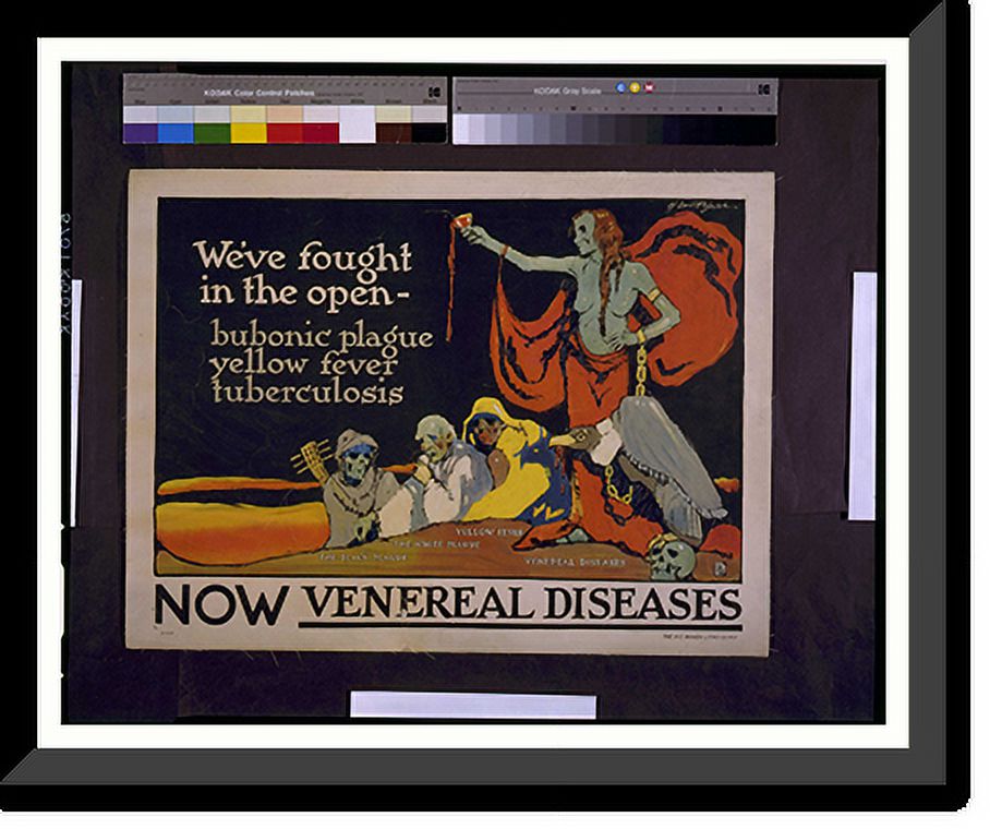 Historic Framed Print, Weve fought in the open - bubonic plague yellow ...