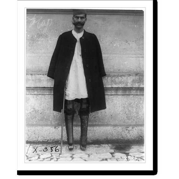 Historic Print, A Serbian soldier returned from prison camp in Austria minus both legs, 16" x 20"
