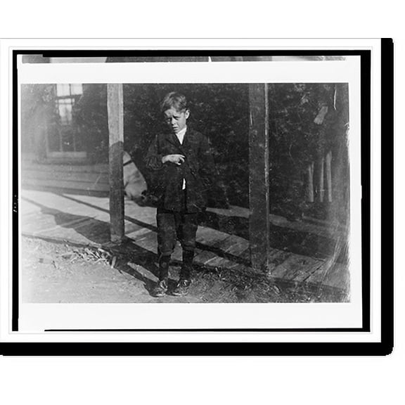 Historic Print, Accident to young cotton mill worker. Giles Edmund Newsom (Photo October 23rd, 1912) while working in Sanders Spinning Mill, Bessemer City, N.C. August 21st, 1912, a pieā¦16" x 20"