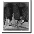 Historic Print, The socalled Lily feet" contrasted with the natural