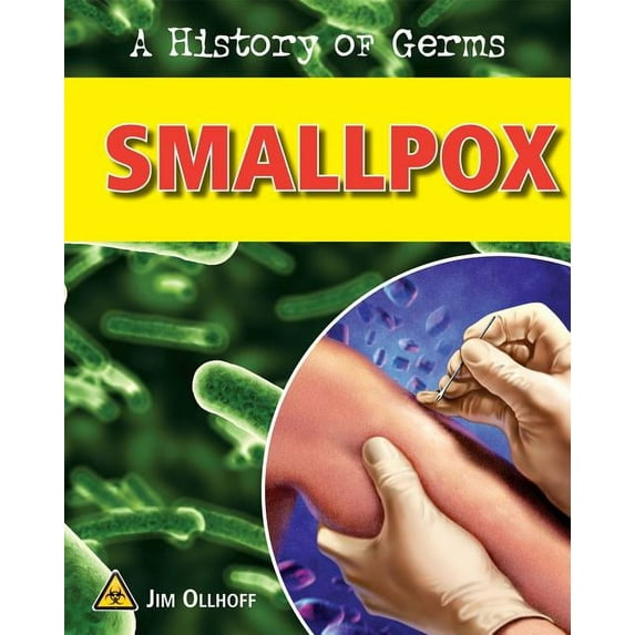 History of Germs: Smallpox (Hardcover)