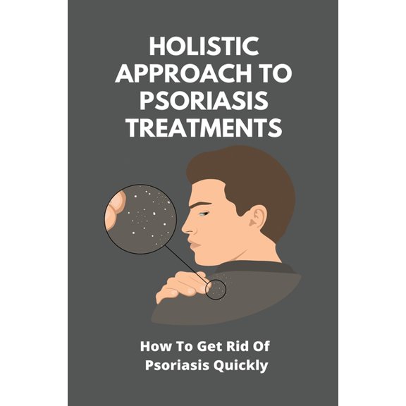 Holistic Approach To Psoriasis Treatments: How To Get Rid Of Psoriasis Quickly: Is Psoriasis Itchy (Paperback)