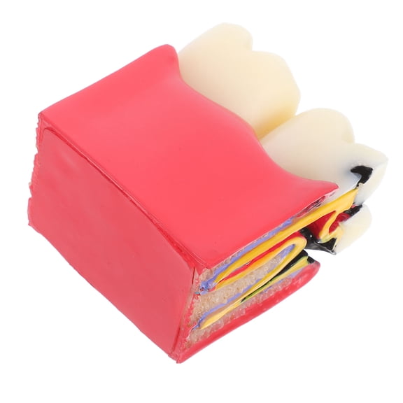 Homoyoyo Tooth Model for Patients Caries Anatomy Education Model Resin 1Pack