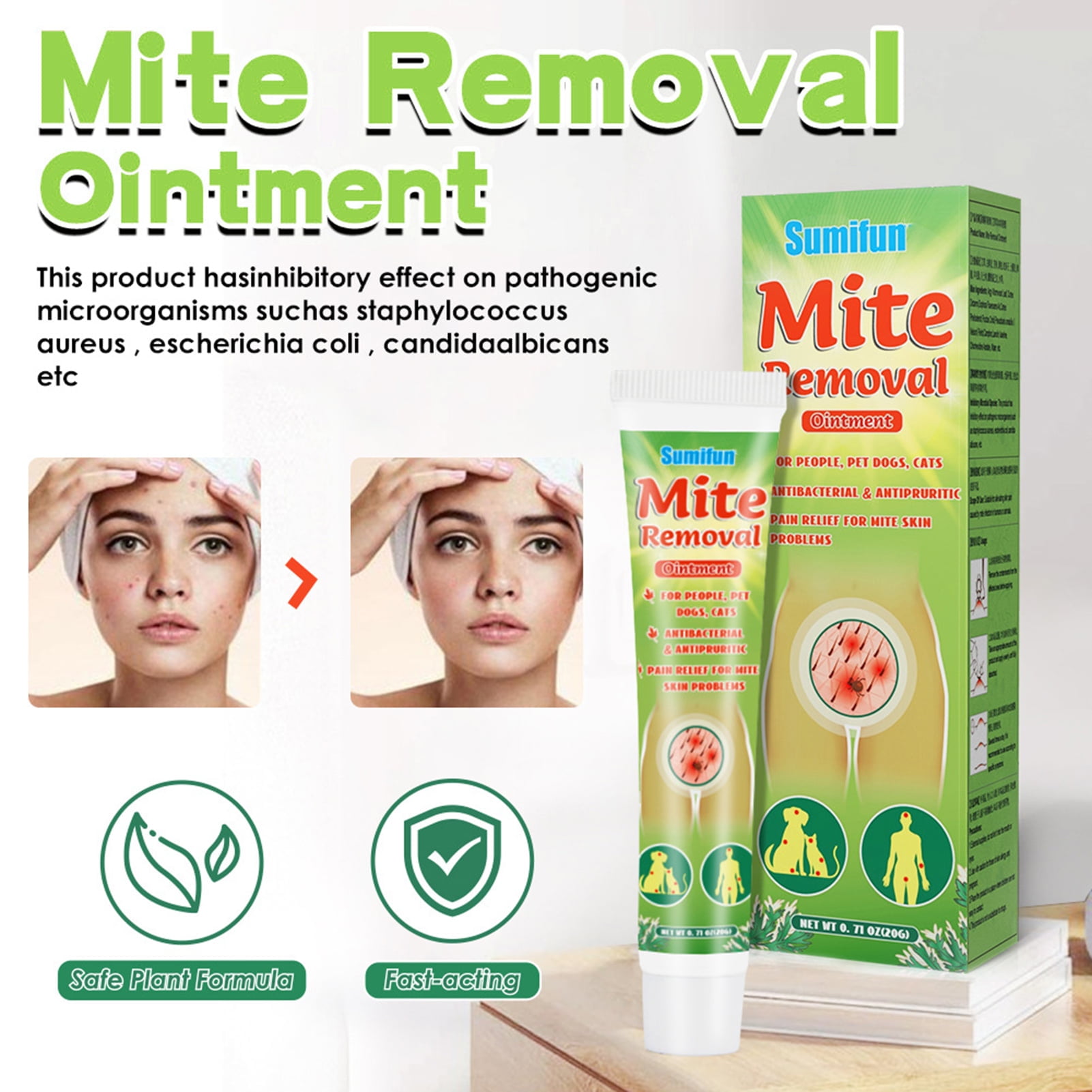 Hopet Mite Removal Cream NonPungent AntiItch External Use Scabies