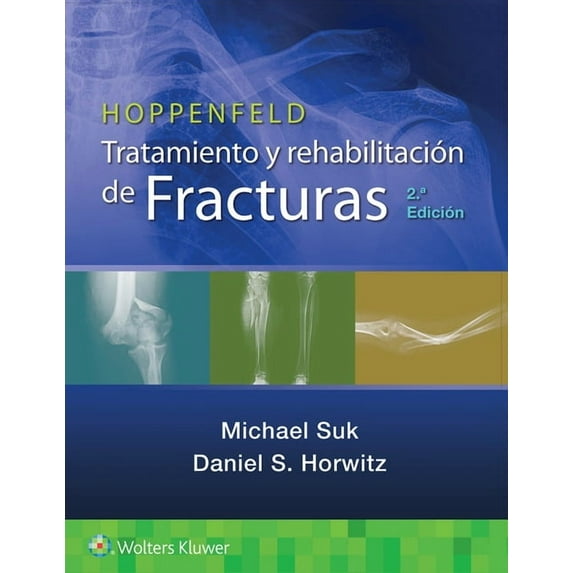 Hoppenfeld. Tratamiento Y Rehabilitación de Fracturas, (Paperback)