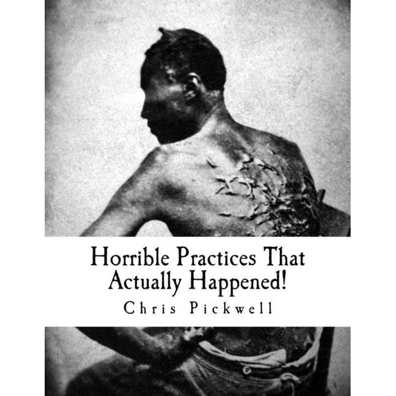 Horrible Practices That Actually Happened! : Caught On Camera (Paperback)