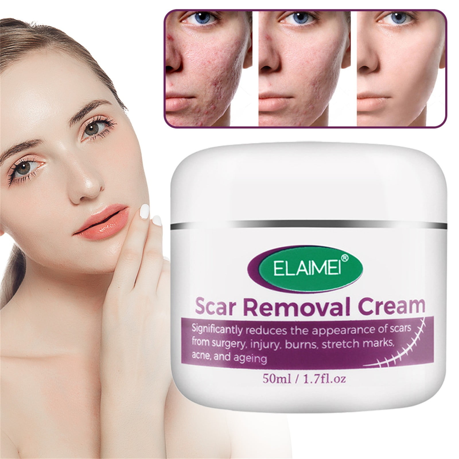 Hot Sale! Scar Removal Cream, Scar Removal Advanced for & Body Old