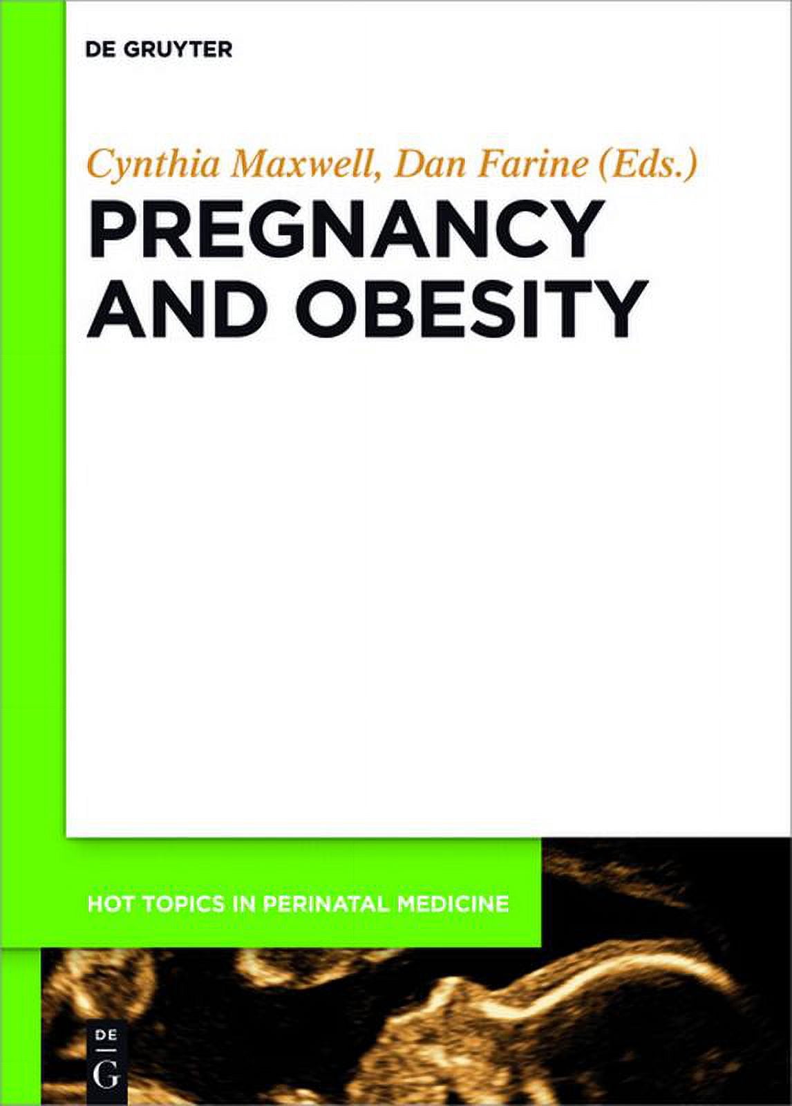 Hot Topics in Perinatal Medicine Pregnancy and Obesity, Book 5, (Hardcover)