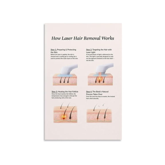 How Hair Removal Works Educational Poster 4 Step Treatment Process Visual Guide Canvas Wall Art For Beauty Salon Clinic Home Decor