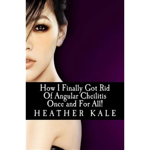 How I Finally Got Rid of Angular Cheilitis Once and for All!: Cracked Mouth Corners No More
