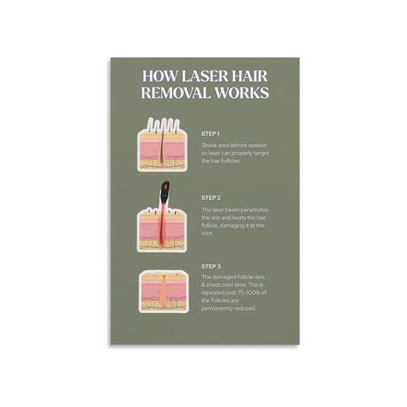 How Laser Hair Removal Works Poster Step By Step Guide Beauty Salon Clinic Decor Canvas Wall Art For Home Office