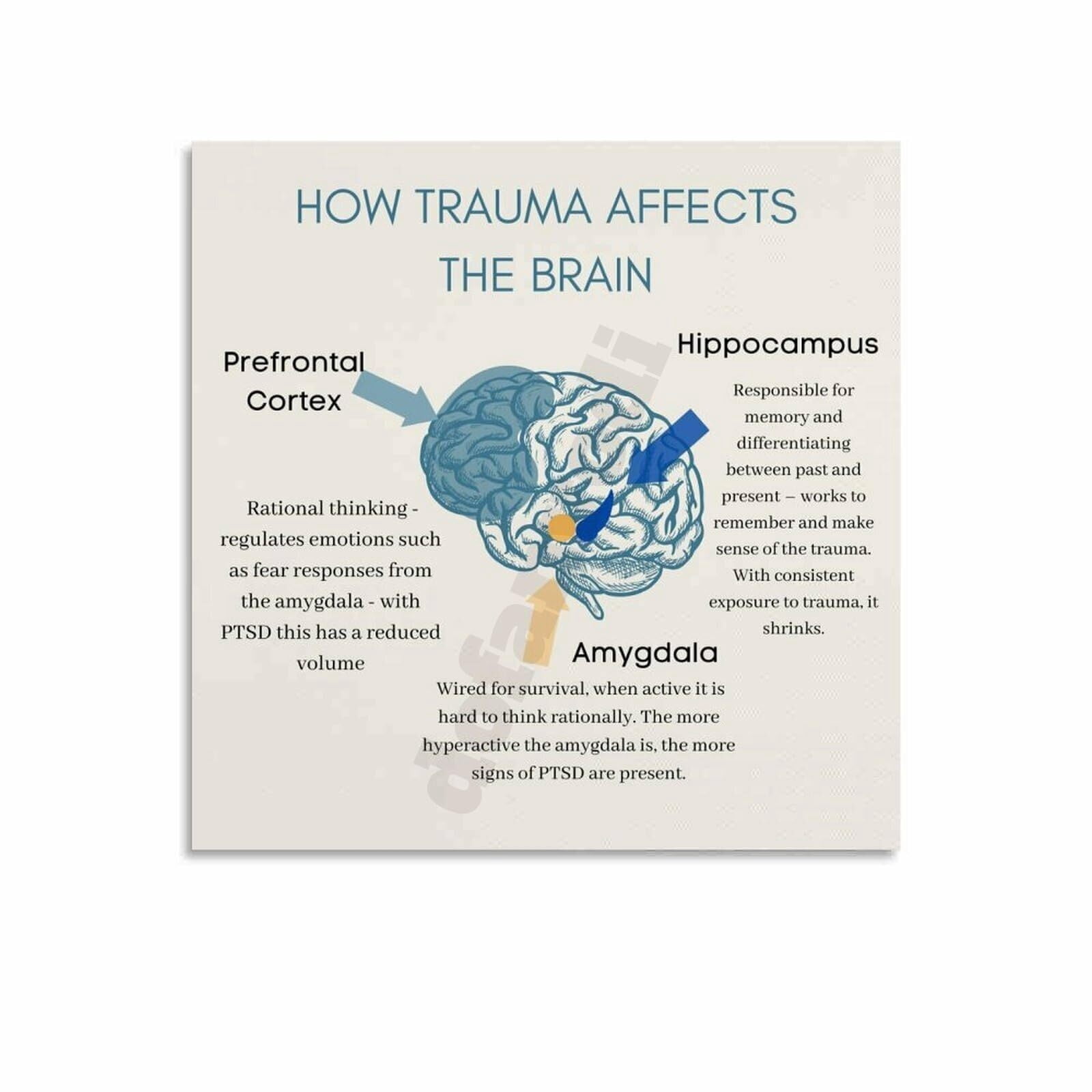 How Trauma Affects The Brain Poster Mental Health Decor (1) Canvas ...