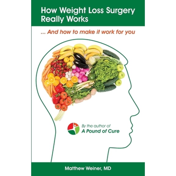 Pre-Owned How Weight Loss Surgery Really Works: And How to Make it Work for You (Paperback) 1688128808 9781688128804