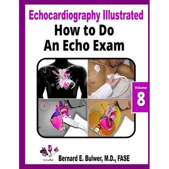 Echocardiography Illustrated: How to Do an Echo Exam (Paperback)