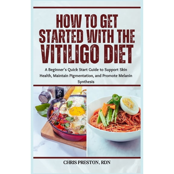 How to Get Started with the Vitiligo Diet: A Beginner's Quick Start Guide to Support Skin Health, Maintain Pigmentation,, (Paperback)