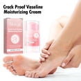 thumbnail image 1 of Hoygi Anti-Crack Hand And Foot Moisturizer, Foot Care Anti-Crack And Dead Skin, Hand And Foot Skin Moisturizer, 1 of 6