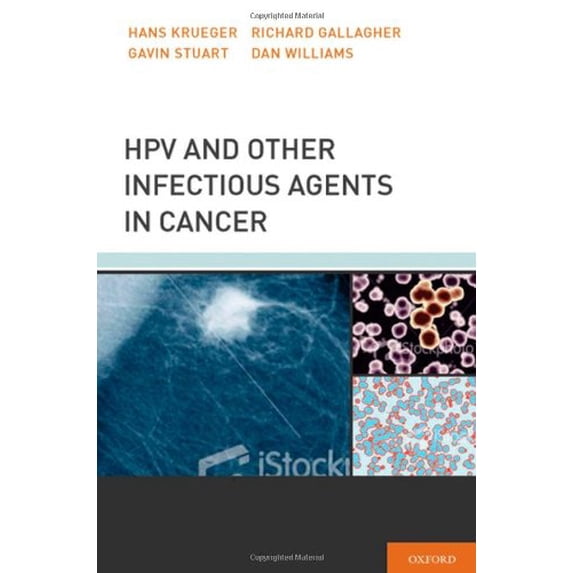 Pre-Owned HPV and Other Infectious Agents in Cancer : Opportunities for Prevention and Public Health 9780199732913 Used