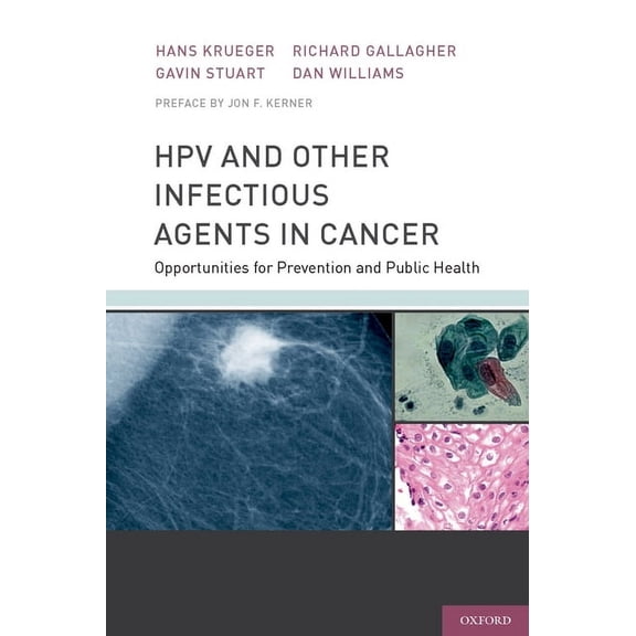 Hpv and Other Infectious Agents in Cancer: Opportunities for Prevention and Public Health, (Hardcover)