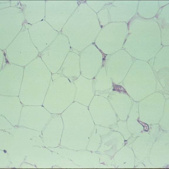 Human Adipose Tissue Slide, 7 M, H&E